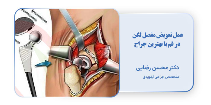 عمل تعویض مفصل لگن در قم با بهترین جراح