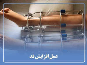 عمل افزایش قد