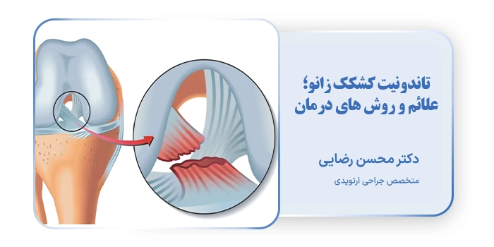 تاندونیت کشکک زانو؛ علائم و روش های درمان