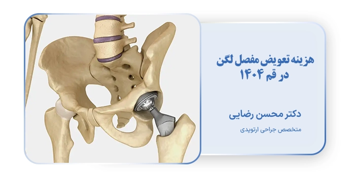 هزینه تعویض مفصل لگن در قم 1404