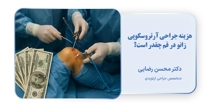 هزینه جراحی آرتروسکوپی زانو در قم چقدر است؟