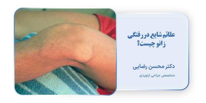علائم شایع دررفتگی زانو چیست؟